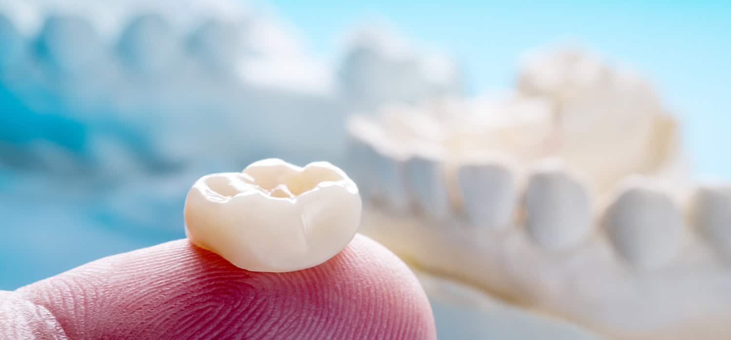 7-things-to-know-about-dental-crowns