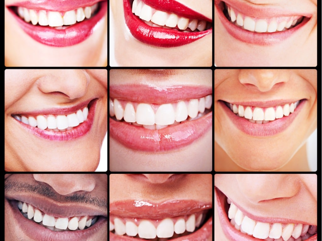 Crazy Facts About Cosmetic Dentistry