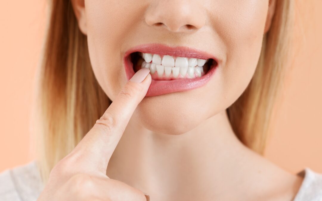 Can Tooth Enamel Erosion Be Reversed?