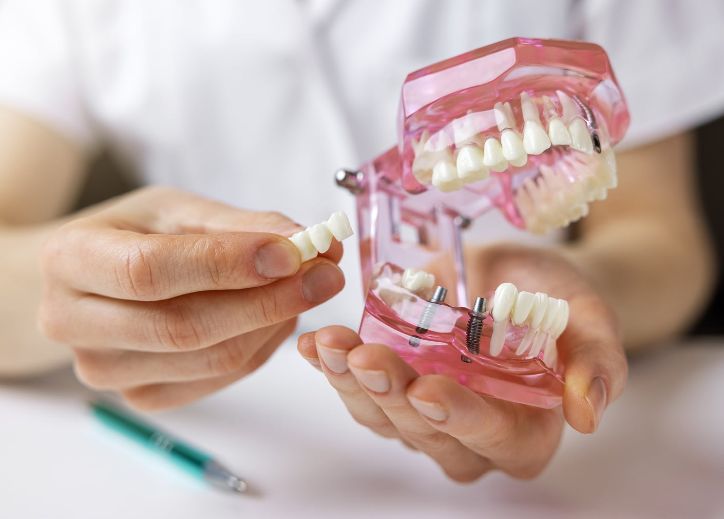 Dental bridges restore smiles for adults with missing teeth